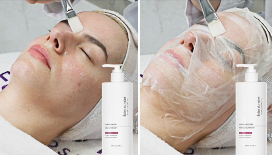 Clarifying Gel and Clarifying Toner