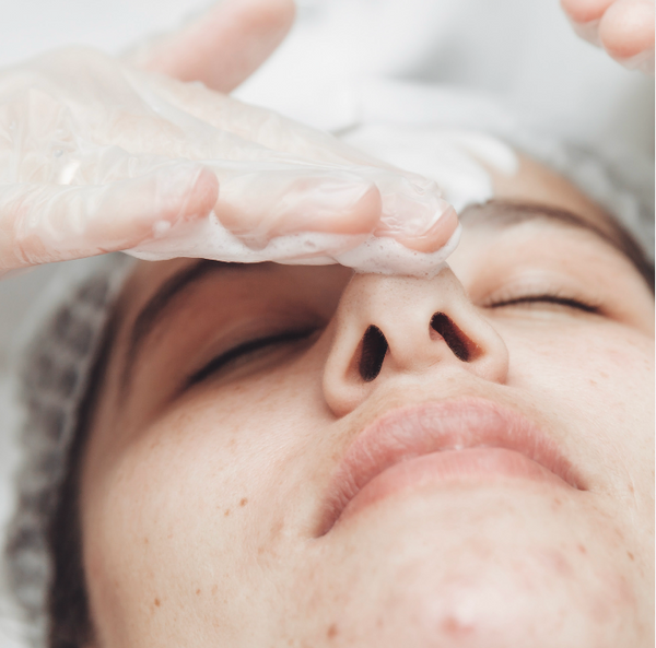 Acne and Inflammation Relief Clarifying Program