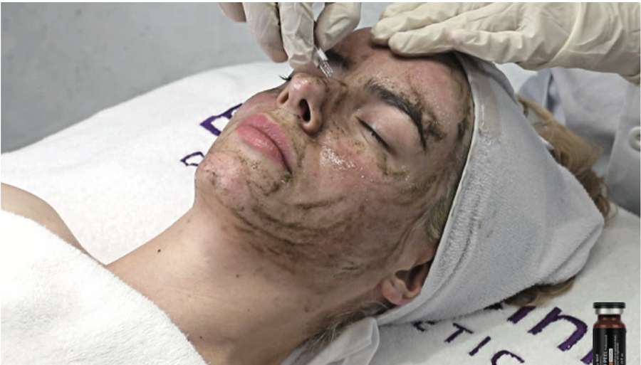 Labo Peel