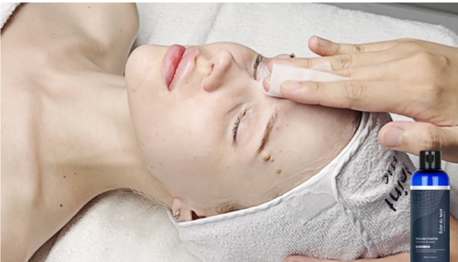 Peeling Starter