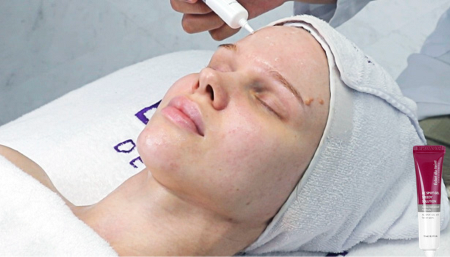 Ac Spot Gel