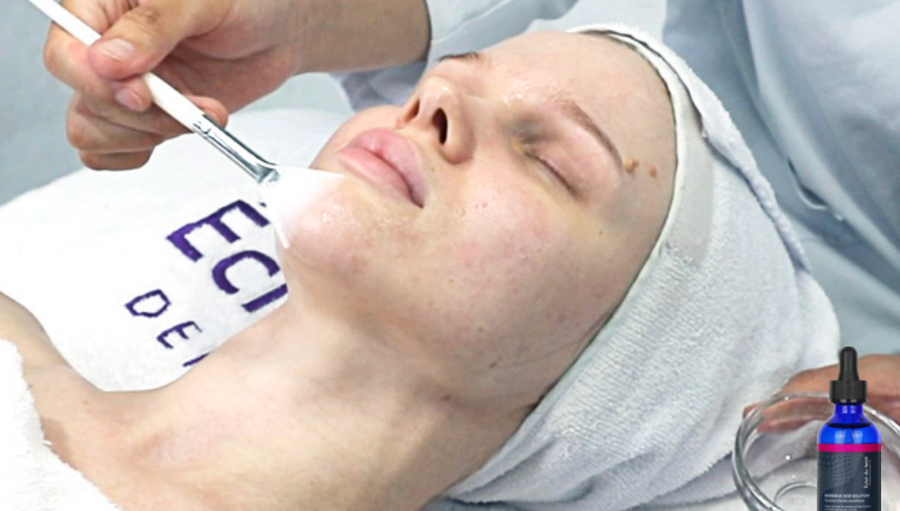 Mandelic Acid Solution